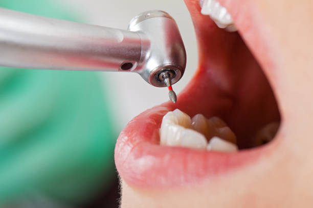 Best Emergency Dental Care for Trauma or Injury in Utica, OH